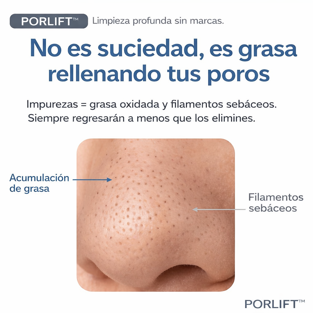 PORLIFT™  Limpia poros