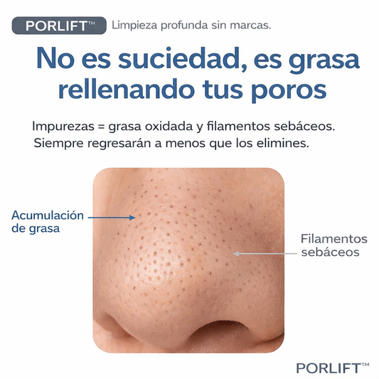 PORLIFT™  Limpia poros