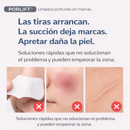 PORLIFT™  Limpia poros