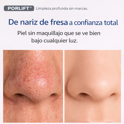 PORLIFT™  Limpia poros